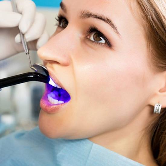 procedure for dental bonding in Arvada
