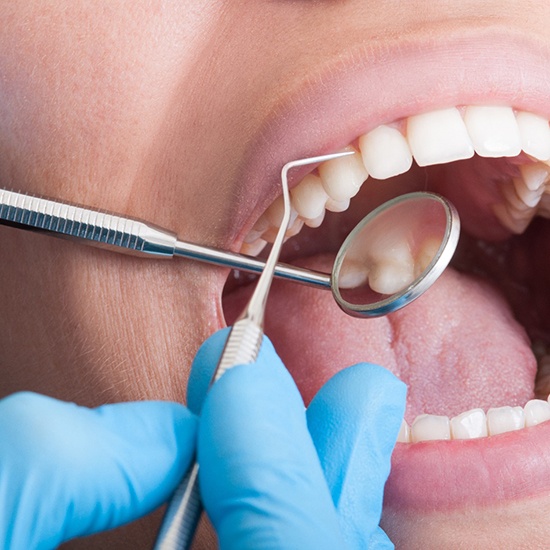 Dentist with blue gloves examining patient's teeth