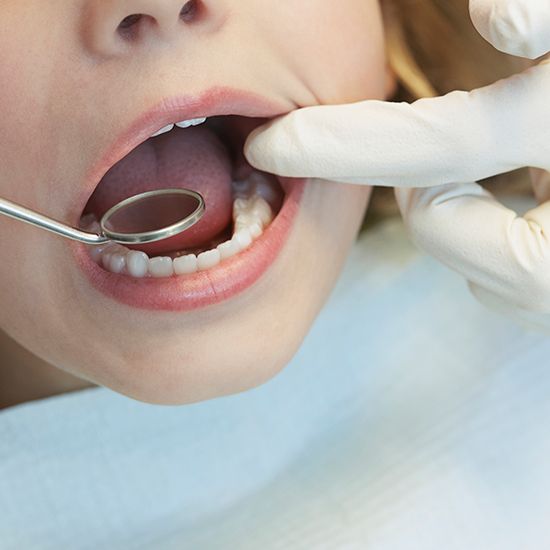 Child receiving dental sealants