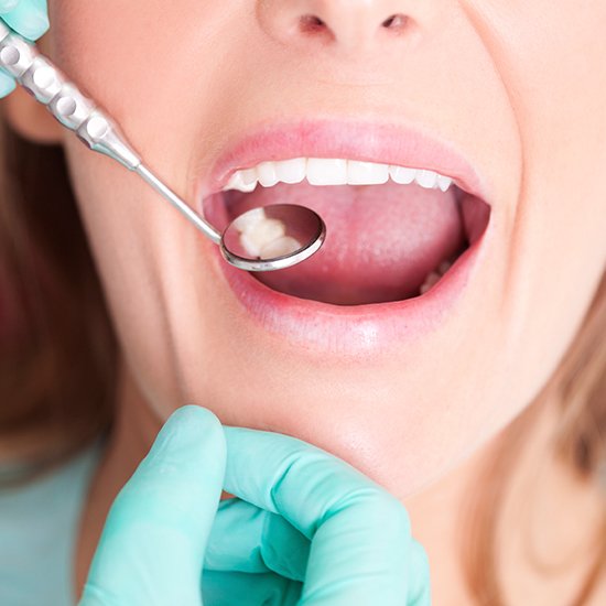 Dentist checking patient's metal free dental restoration