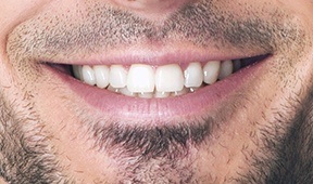 Example of front of mouth image