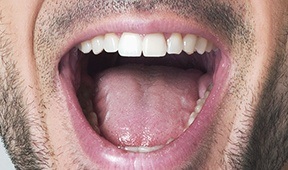 Example of open mouth up smile